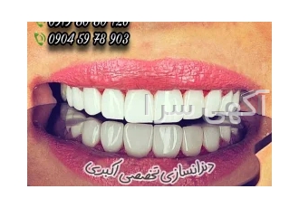 دندانسازی‌تخصصی (بدون نیازبه ایمپلنت وباهزینه کم دندان داشته باشید)
