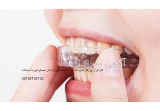 ساخت نایت گارد دندانپزشکی بدون واسطه نایتگارد دندان ساخت نایت گارد