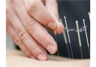 کلاس فشرده 4 روزه طب سوزنی در کرج
