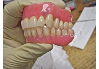 لابراتوار دندانسازی ساخت دندان مصنوعی با ضمانت