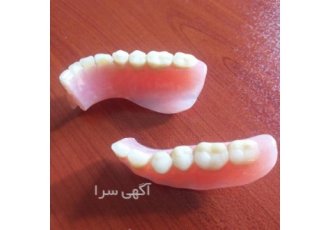 لابراتوار دندانسازی متحرک ساخت تعمیرات شکستگی لقی ساخت و تعمیر شکستگی