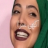 ایمپلنت دندان و کامپوزیت دندان لمینت سرامیکی در تهران دندان های شما