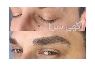 میکروبلیدینگ ابرو اقایان