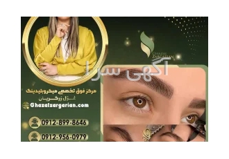 میکروبلیدینگ غزل زرگریان با روش های تخصصی در تهران بهترین روش