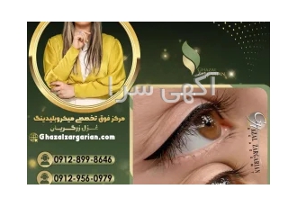 تاتو خط چشم در غرب تهران داشتن چشم های زیبا و جذاب همیشه آرزوی بانوان