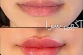 قرص دیر انزالی دیجی کالا