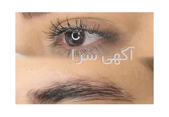 مدل جهت میکروبلیدینگ