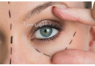 تزریق ژل لب/ ژل چانه/ژل گونه/ فیلر بینی در نگین گرگان