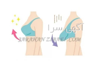 جراحی ماموپلاستی شمال تهران کلینیک جراحان زیبایی جردن با برخورداری