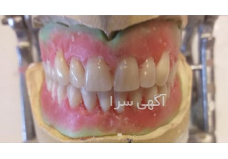 لابراتوار دندانسازی دندان ساز مصنوعی سیار در محل خانه قالبگیری و ساخت