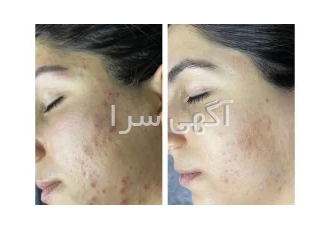 کلینیک فشیشیال تخصصی دادمان در تهران خدمات فیشیال تخصصی کلینیک دادمان