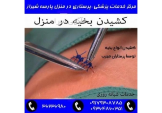 کشیدن بخیه در منزل شیراز کشیدن انواع بخیه های در منزل در سراسر شیراز