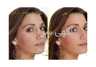ویرایش عکس حرفه ای در تهران ویرایش حرفه ای عکس تخصص ماست رویای هنر