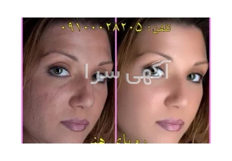 نرم افزارهای ویرایش عکس و پلاگین های فتوشاپ و لایتروم