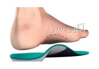 اسکن کف پا در پونک در تهران کارشناس ارتز و پروتز سجاد اسماعیلیان جاوید