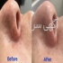 کلینیک درمانی واریس در تهران درمان قطعی واریس در کلینیک واریس ✴️ روش