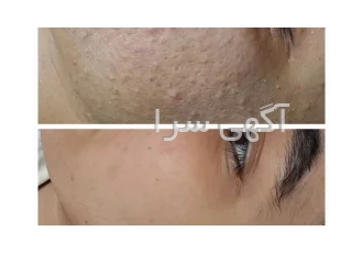 مدل خدمات فیشیال و پاکسازی پوست (رایگان)