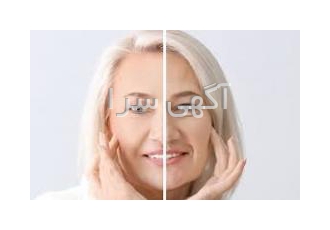 رفع چین و چروک وشلی پوست تمام بدن در اهواز با افزایش سن سلولهای شما