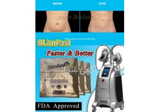 فروش پد آنتی فریز کرایولیپولیز SLimfast بدون سوختگی چرا پدهای
