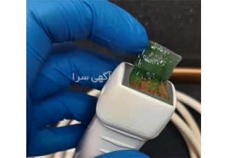 تعمیرات پروب سونوگرافی در تهران اتجام تعمیرات پروب سونوگرافی بیمارستان
