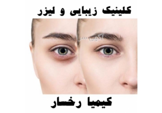 مرکز تزریق فیلر تزریق فیلر بینی در قائم شهر کلینیک زیبایی و لیزر