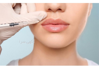 خرید و فروش عمده ژل و بوتاکس در تبریز بازرگانی ریتا ما در این مجموعه