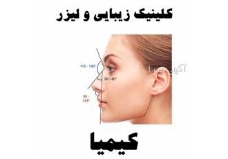 زاویه سازی صورت در قائم شهر کلینیک زیبایی و لیزر کیمیا ارائه دهنده
