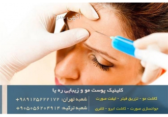 تزریق فیلر در کلینیک زیبایی ره یا