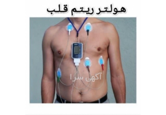 اجاره دستگاه هولتر فشار خون  و هولتر قلب