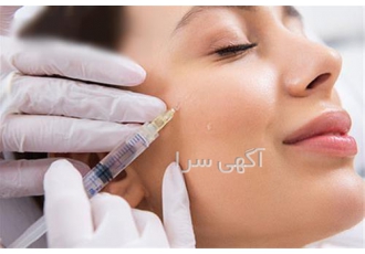 فروش عمده ژل و بوتاکس