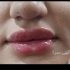 آموزش و تزریق ژل و بوتاکس به صورت حرفه ای در شیراز با سلام آموزش بوتاکس