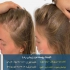 تزریق ژل به لب و خدمات زیبایی پوست و مو در ره یا در تهران بهترین سن