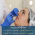 جوانسازی صورت با تزریق بوتاکس در کلینیک زیبایی در تهران جوانسازی صورت