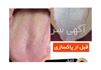 درمان با طب سنتی در اصفهان زبان آیینه بدن است تشخیص تمامی بیماری