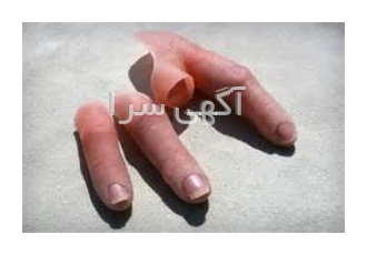 فروش سیلیکون مدیکال و فروش سیلیکون فودگرید
