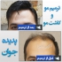 مشاوره رایگان (ترمیم مو پدیده جوان) در تهران بسمه تعالی خدمت مدیریت