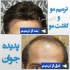 مشاوره رایگان (ترمیم مو پدیده جوان) در تهران بسمه تعالی خدمت مدیریت