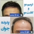 مشاوره رایگان (ترمیم مو پدیده جوان) در تهران بسمه تعالی خدمت مدیریت