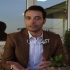 مشاوره رایگان کاشت مو با روش Beard Transplant در تهران مشاوره رایگان