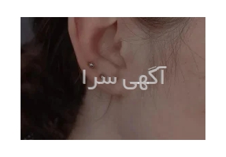 انجام خدمات پیرسینگ چال لپ و میکرودرمال در اصفهان انجام خدمات پیرسینگ