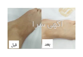 ورکشاپ آموزش تکنیک پوست ماری در آکادمی پوست سیما کاظم بیگی در تهران ❌️