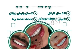 کامپوزیت زیبایی دندان در تهران کامپوزیت زیبایی دندان با بهترین برند