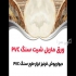 ماربل شیت &#۱۶۰;سنگ مصنوعی &#۱۶۰;دیوارپوش PVC در تهران سامیت تهران