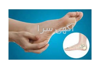 خار پاشنه درمان در اهواز توجه کنید مهم ## شاک ویو تراپی برای خارپاشنه