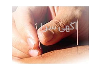 کلینیک طب سوزنی دکتر فرهاد همت خواه متخصص طب سوزنی Dr Farhad Hemmatkhah