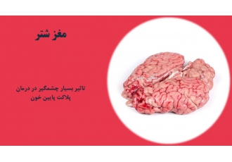 مغز شتر آسایش