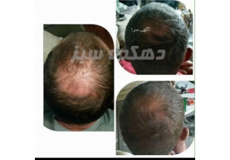 روغن مورینگا مخصوص مو مورینگا انباری از تمام مواد مغذی مورد نیاز