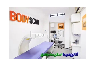 سنجش ناهنجاری اسکلتی و اسکن کف پا در تهران اسکن کف پا سنجش ناهنجاری