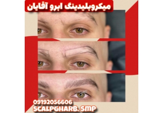 میکروبلیدینگ ابرو آقایان تهران رفع کمپشتی و نواقص ابرو از قبیل شکستگی