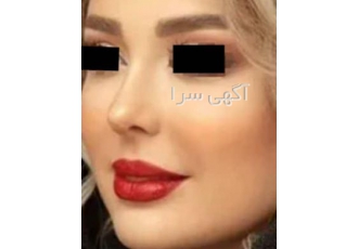 عمل های جراحی زیبایی توسط تیم با تجربه ‌با نازلترین قی عمل جراحی